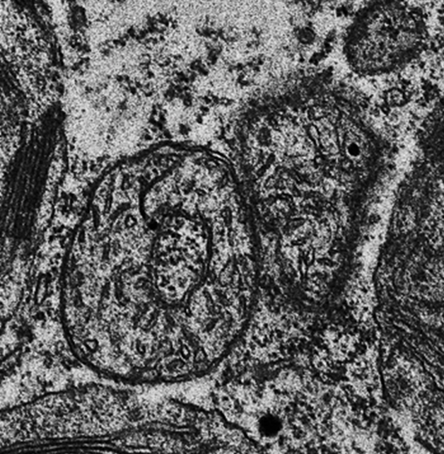 Estudo inédito decifra mecanismo-chave da comunicação celular entre mitocôndria e núcleo na resposta a estresses das plantas
